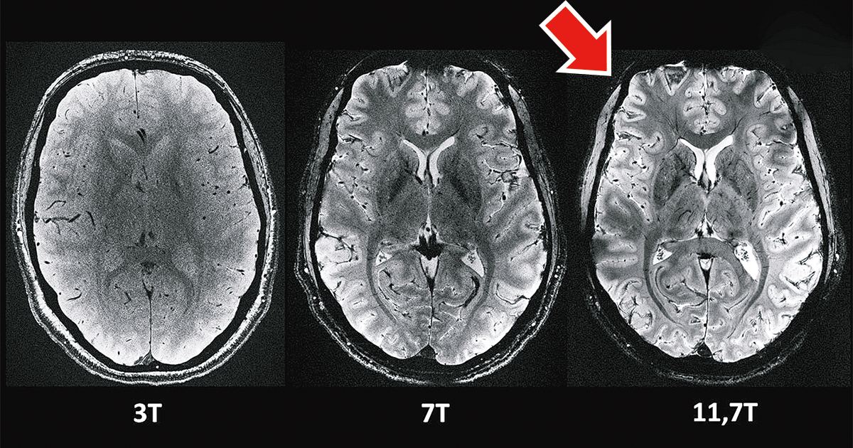 全球最強磁力共振機器｜超高清人腦MRI影像曝光- EJ Tech